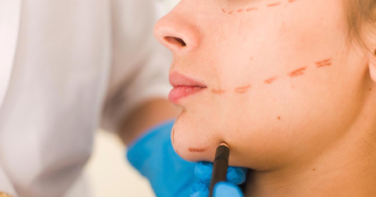 Anti-Aging Treatment In Bangalore